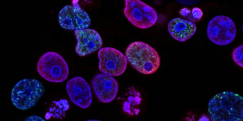 Cancer cells replicating indefinitely